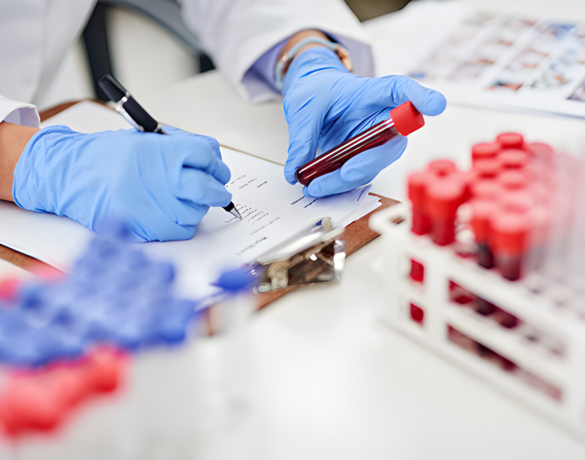 Laboratory Test