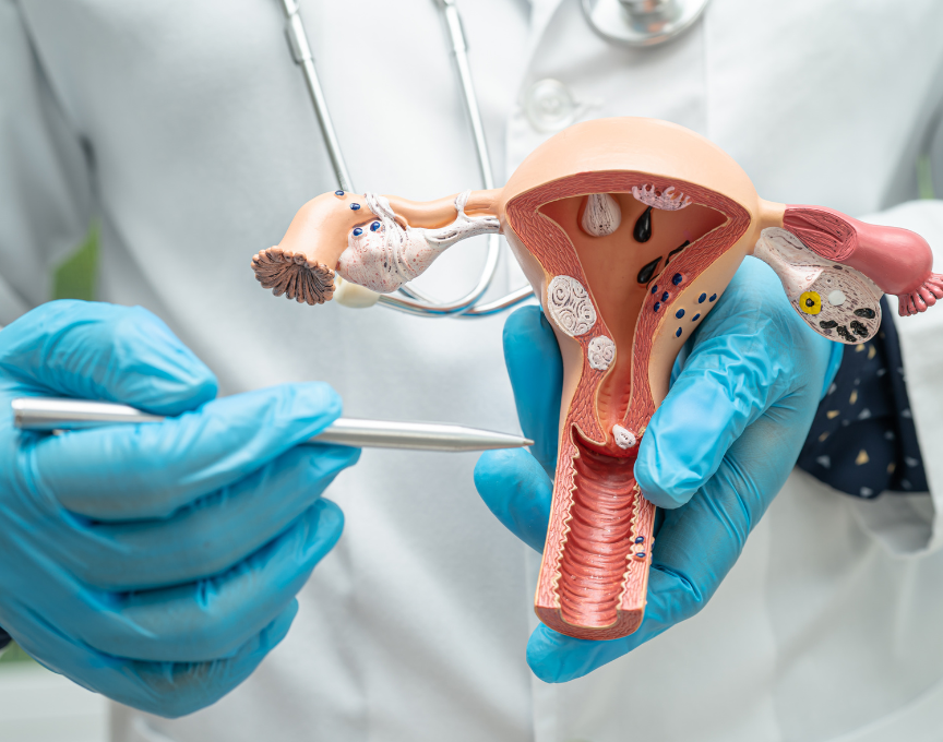 Gynecology
