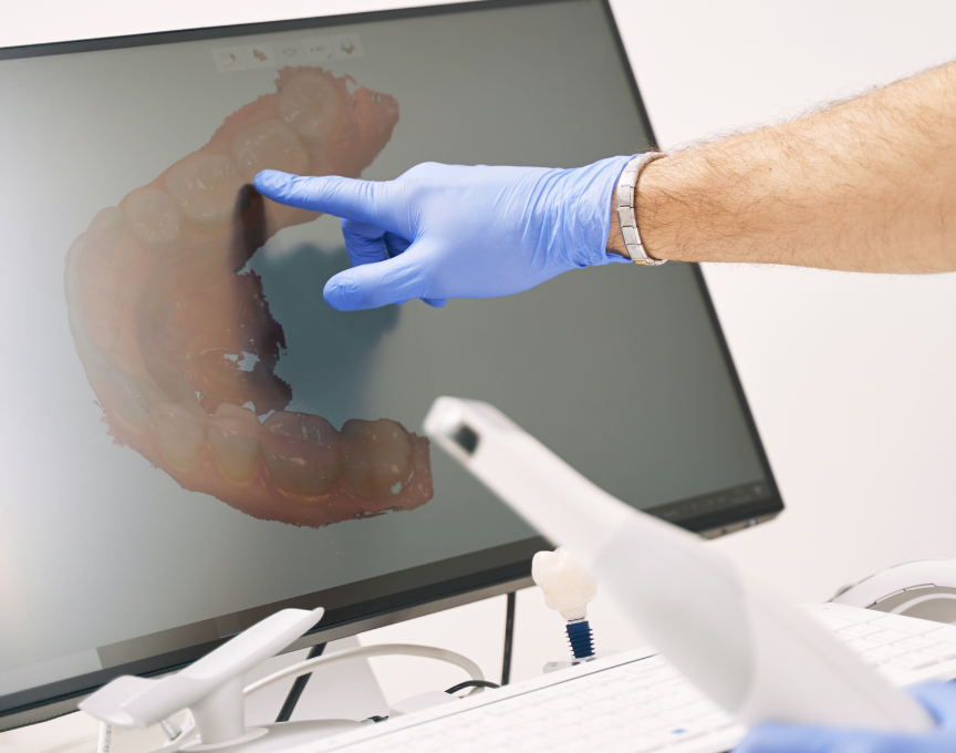 Dental CT Scanner Service
